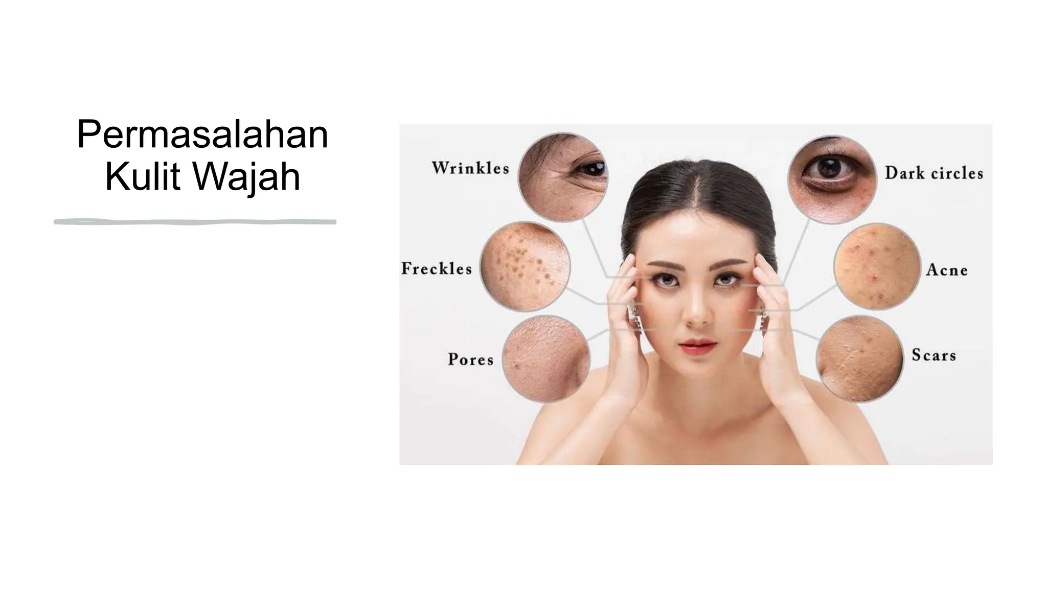 Understanding Skin Health in Cilacap: Tips from London Beauty Centre